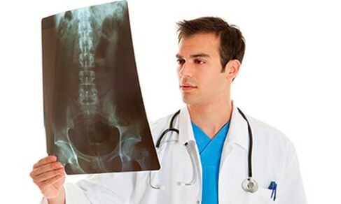 az orvos röntgenvizsgálatot végez a derékfájás diagnosztizálásához