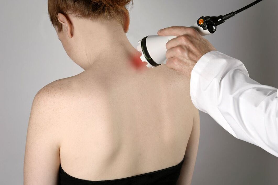 A nyaki osteochondrosis fizioterápiás kezelése
